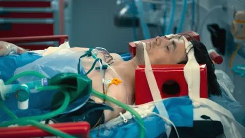 BBC/ExpectationTV A man lying on a hospital bed with his neck in a brace. There are wires and tubes attached to his chest; his eyes are closed.